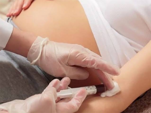 How to Pass the Gestational Diabetes Test: What the Glucose Screening Actually Involves